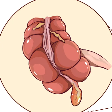 Аппендицит: симптомы и первые признаки